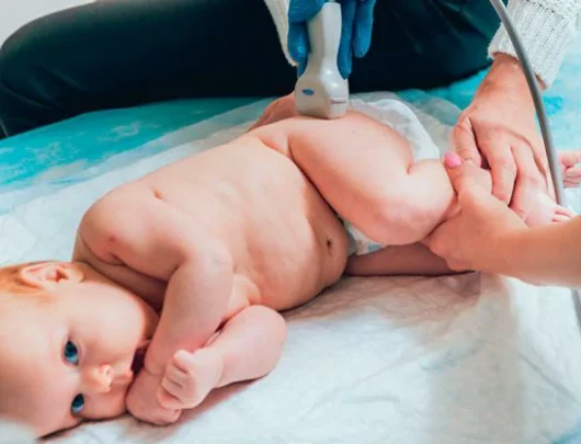 ultrasonido-de-cadera